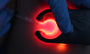 ESPECIALISTA ESCLEROTERAPIA